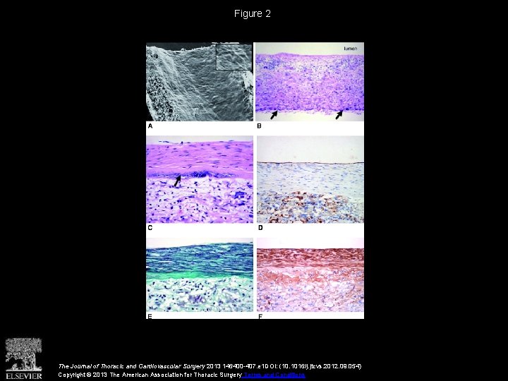 Figure 2 The Journal of Thoracic and Cardiovascular Surgery 2013 146400 -407. e 1