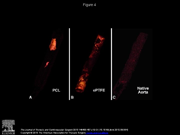 Figure 4 The Journal of Thoracic and Cardiovascular Surgery 2013 146400 -407. e 1