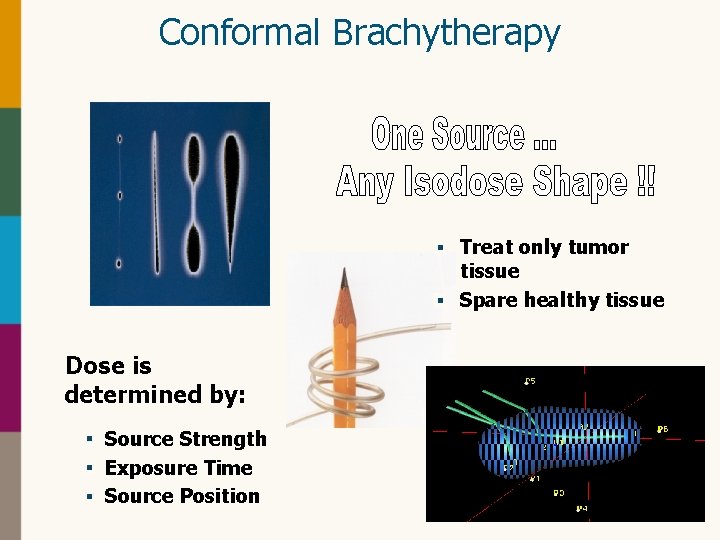 Conformal Brachytherapy Treat only tumor tissue Spare healthy tissue Dose is determined by: Source