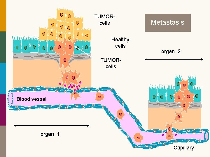 TUMORcells Healthy cells CARCINOMA TRANSPORT INVASIE AANHECHTING HYPERPLASIE EXTRAVASATIE INTERVASATIE DYSPLASIE Metastasis IN SITU