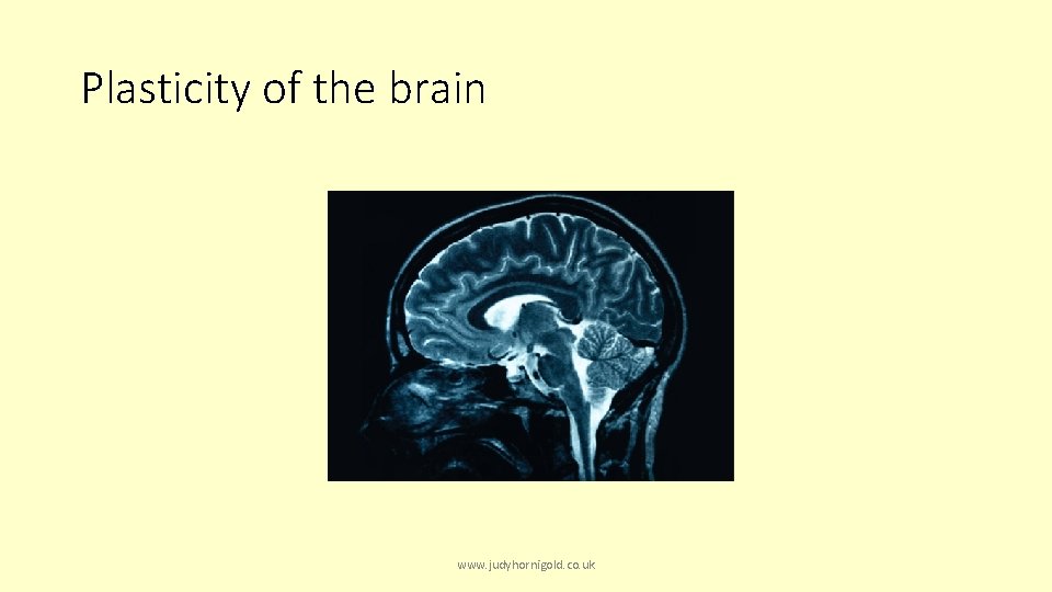 Plasticity of the brain www. judyhornigold. co. uk 