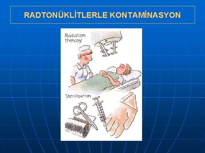 RADTONÜKLİTLERLE KONTAMİNASYON 