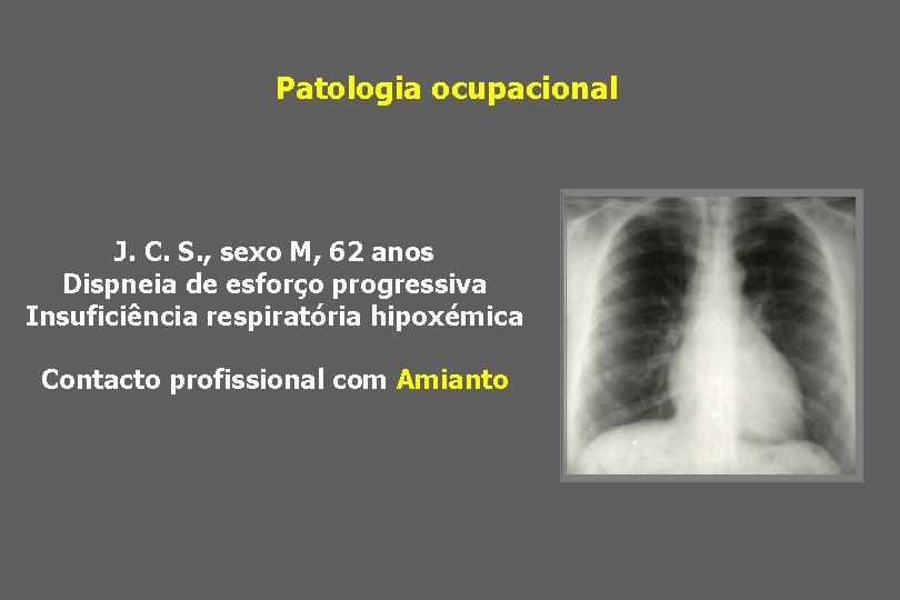 Patologia ocupacional J. C. S. , sexo M, 62 anos Dispneia de esforço progressiva
