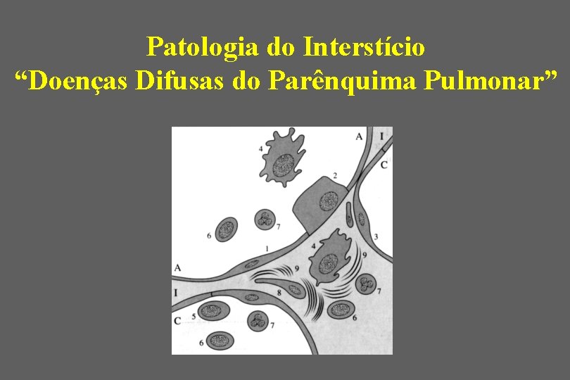 Patologia do Interstício “Doenças Difusas do Parênquima Pulmonar” 