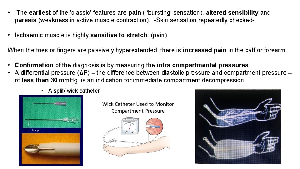  • The earliest of the ‘classic’ features are pain ( ‘bursting’ sensation), altered