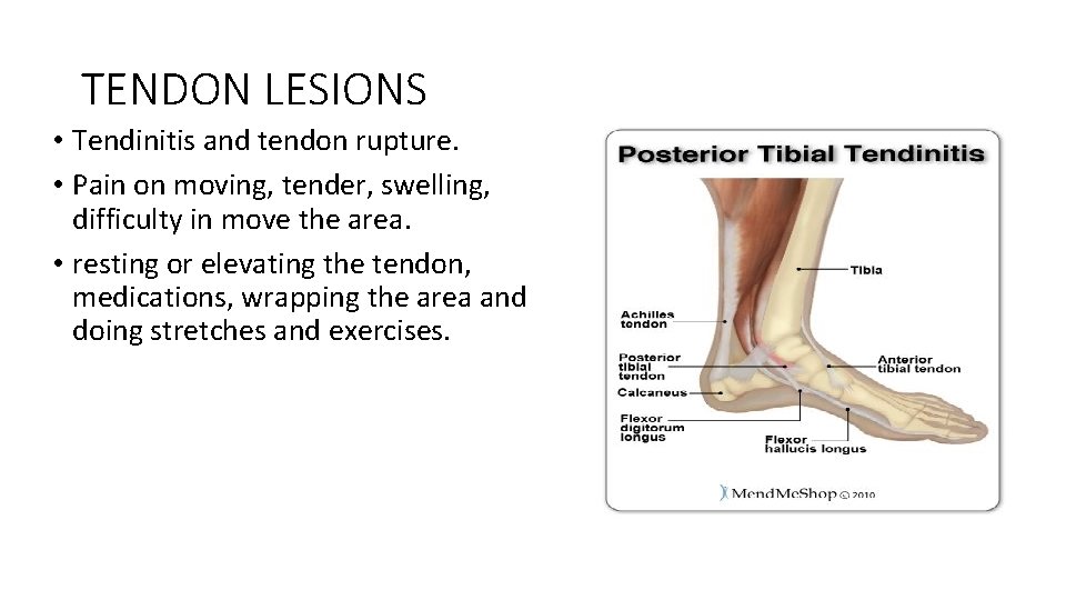 TENDON LESIONS • Tendinitis and tendon rupture. • Pain on moving, tender, swelling, difficulty