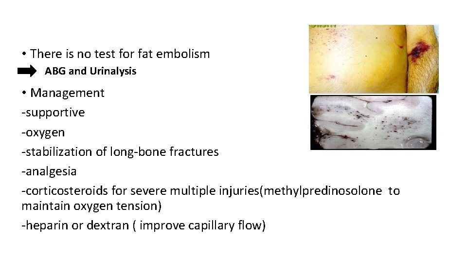  • There is no test for fat embolism ABG and Urinalysis • Management