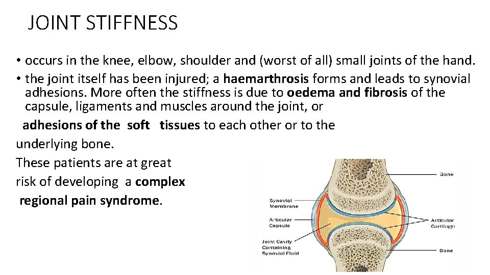 JOINT STIFFNESS • occurs in the knee, elbow, shoulder and (worst of all) small