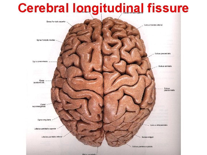 Cerebral longitudinal fissure 