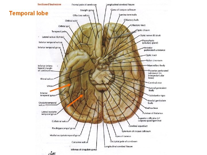 Temporal lobe 