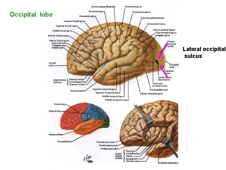Occipital lobe Lateral occipital sulcus 