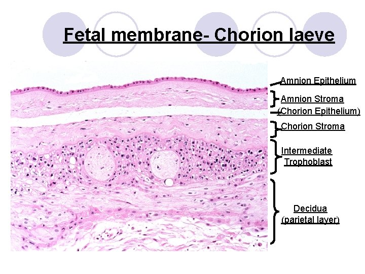 Fetal membrane- Chorion laeve Amnion Epithelium Amnion Stroma (Chorion Epithelium) Chorion Stroma Intermediate Trophoblast