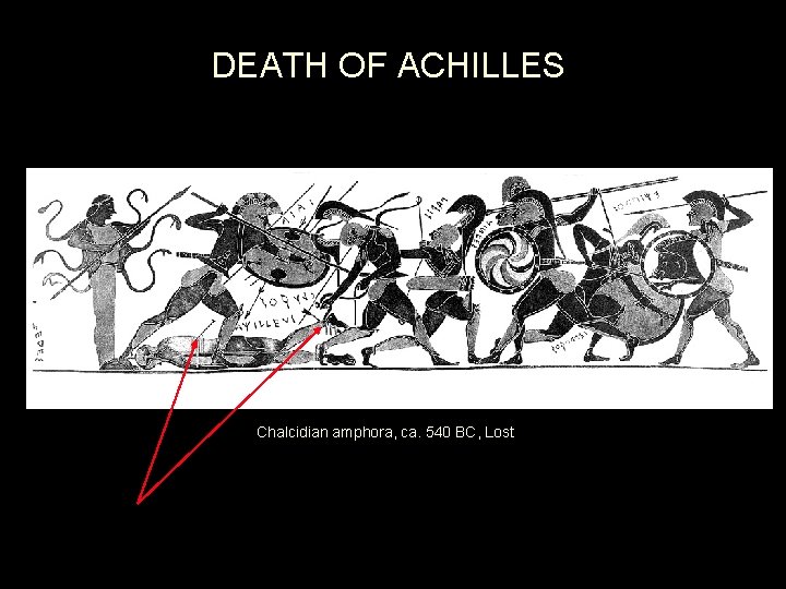 DEATH OF ACHILLES Chalcidian amphora, ca. 540 BC, Lost 