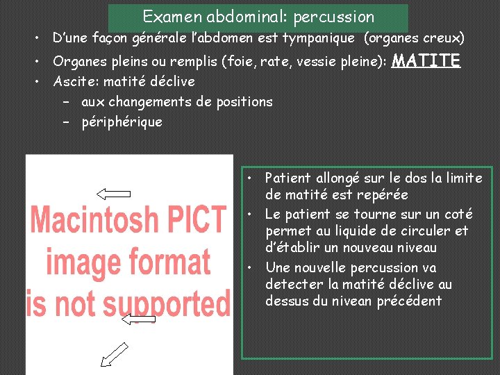 Examen abdominal: percussion • D’une façon générale l’abdomen est tympanique (organes creux) • Organes