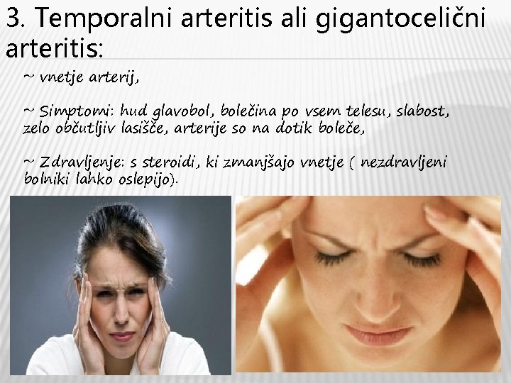 3. Temporalni arteritis ali gigantocelični arteritis: ~ vnetje arterij, ~ Simptomi: hud glavobol, bolečina