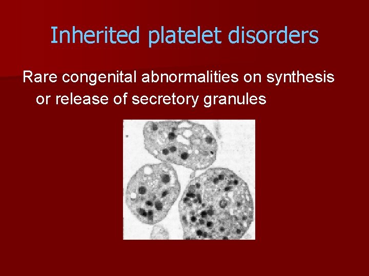 Inherited platelet disorders Rare congenital abnormalities on synthesis or release of secretory granules 