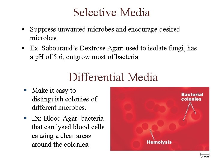 Selective Media • Suppress unwanted microbes and encourage desired microbes • Ex: Sabouraud’s Dextrose