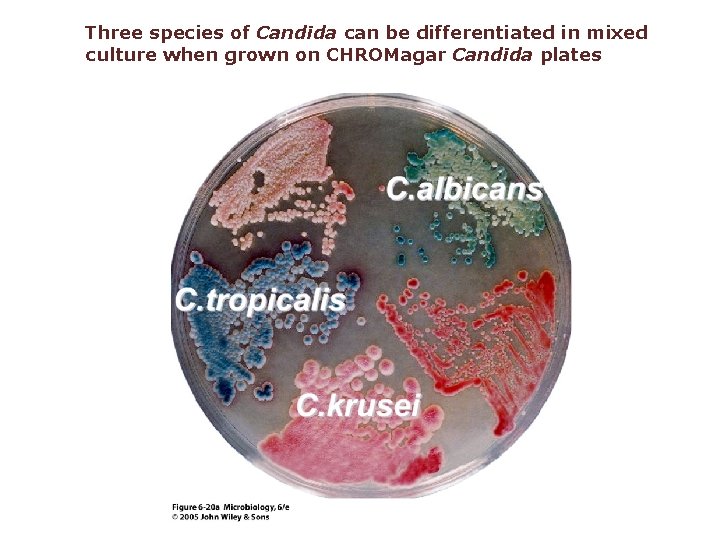 Three species of Candida can be differentiated in mixed culture when grown on CHROMagar