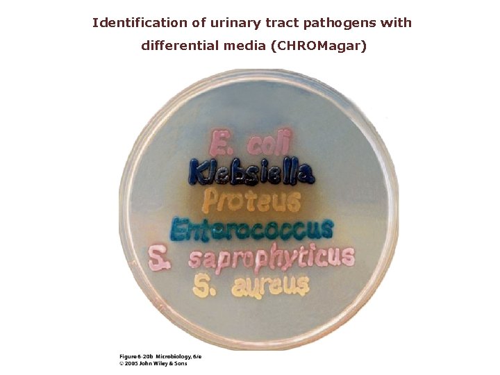 Identification of urinary tract pathogens with differential media (CHROMagar) 