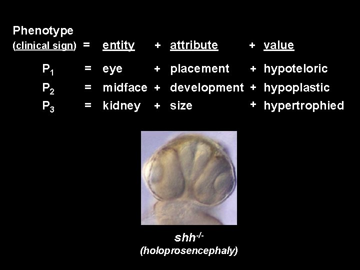 Phenotype (clinical sign) = entity + attribute + value + placement + hypoteloric P