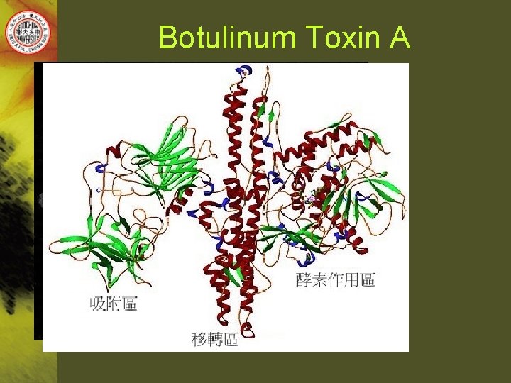 Botulinum Toxin A 