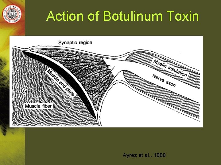 Action of Botulinum Toxin Ayres et al. , 1980 