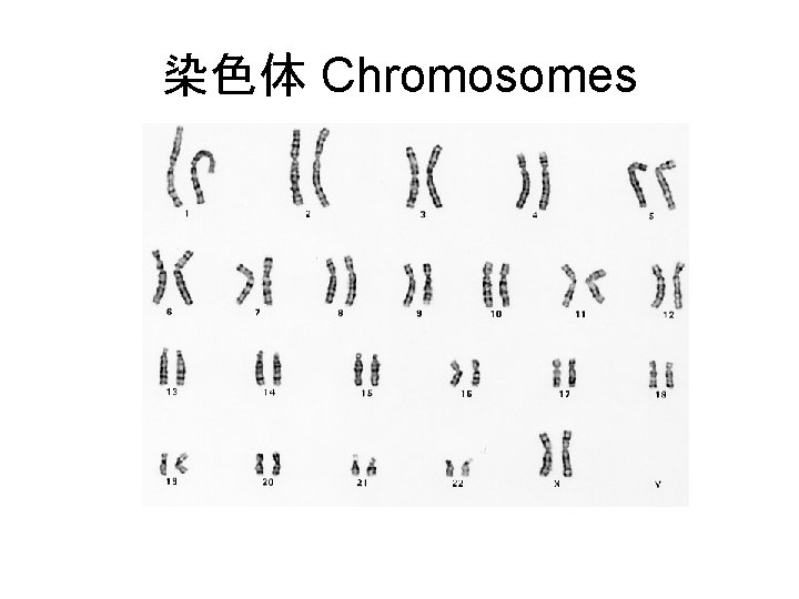 染色体 Chromosomes 