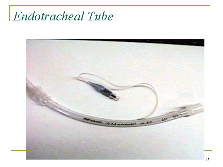 Endotracheal Tube 18 