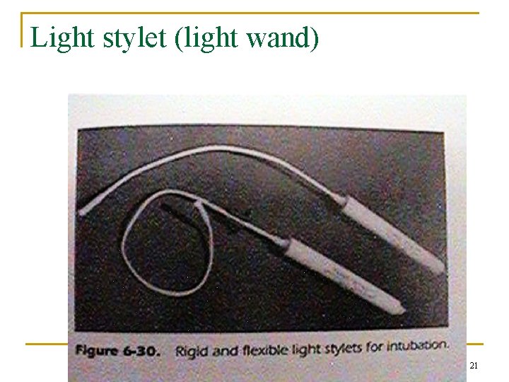 Light stylet (light wand) 21 