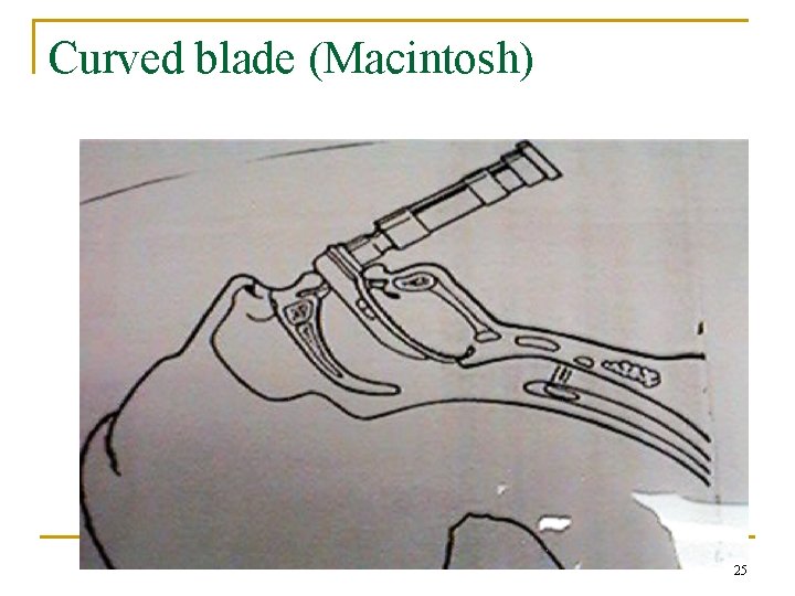 Curved blade (Macintosh) 25 