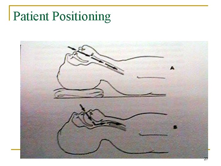Patient Positioning 27 