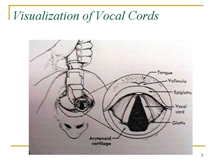 Visualization of Vocal Cords 3 