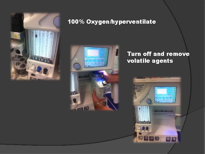 100% Oxygen/hyperventilate Turn off and remove volatile agents 