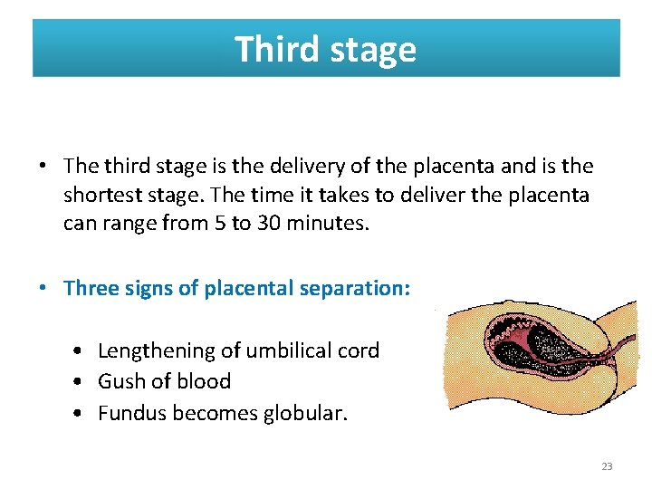 Third stage • The third stage is the delivery of the placenta and is