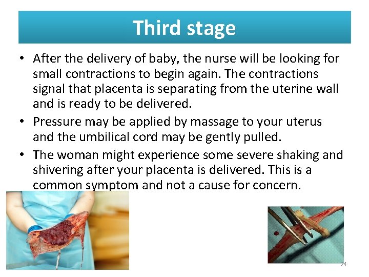 Third stage • After the delivery of baby, the nurse will be looking for