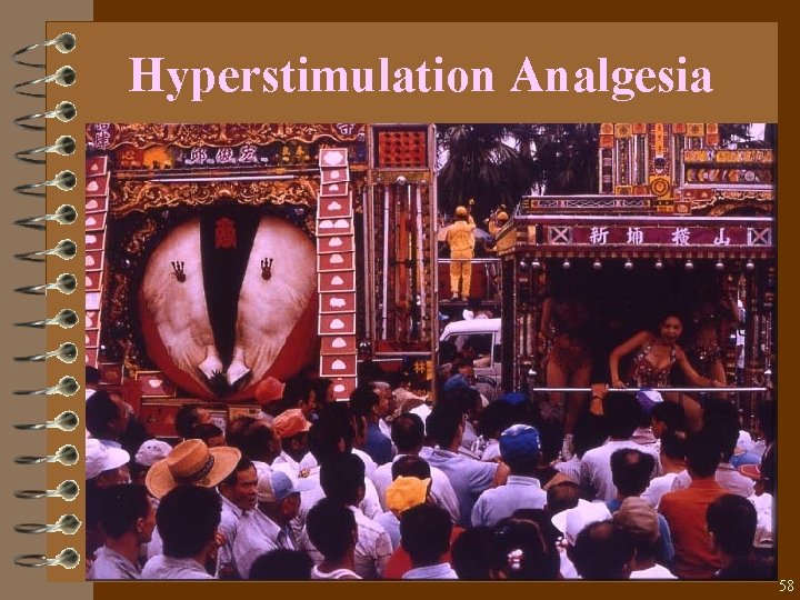 Hyperstimulation Analgesia 58 