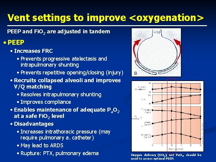 Vent settings to improve <oxygenation> PEEP and Fi. O 2 are adjusted in tandem