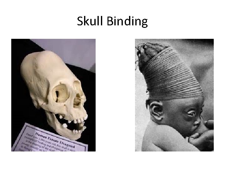 Skull Binding 