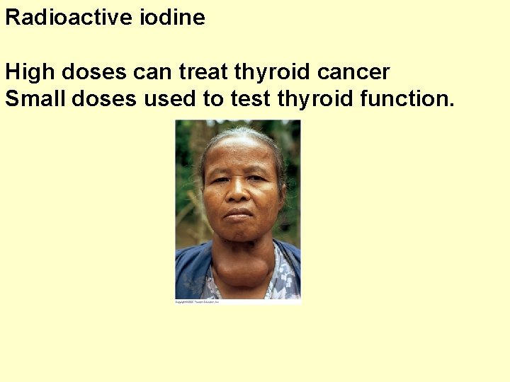 Radioactive iodine High doses can treat thyroid cancer Small doses used to test thyroid