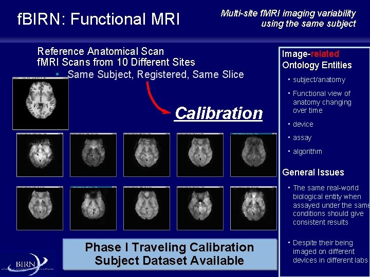 f. BIRN: Functional MRI Multi-site f. MRI imaging variability using the same subject Reference