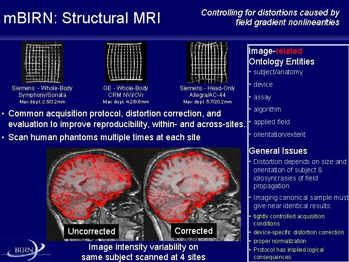 m. BIRN: Structural MRI Controlling for distortions caused by field gradient nonlinearities Image-related Ontology