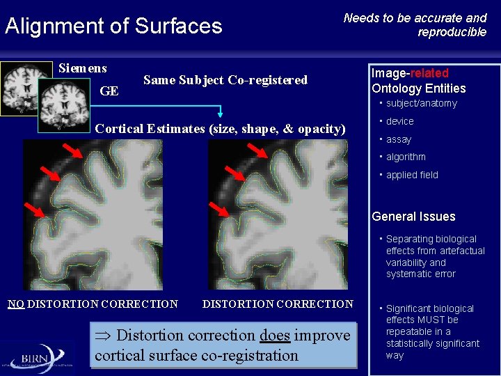 Alignment of Surfaces Siemens GE Needs to be accurate and reproducible Same Subject Co-registered