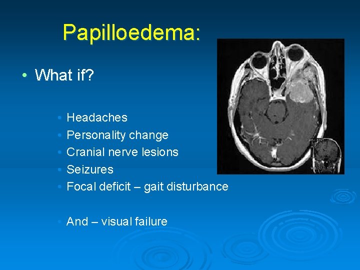 Papilloedema: • What if? • • • Headaches Personality change Cranial nerve lesions Seizures