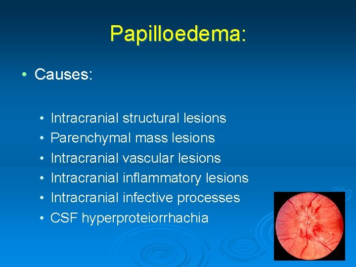 Papilloedema: • Causes: • • • Intracranial structural lesions Parenchymal mass lesions Intracranial vascular