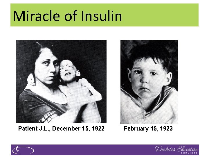 Miracle The Miracleof of Insulin Patient J. L. , December 15, 1922 February 15,