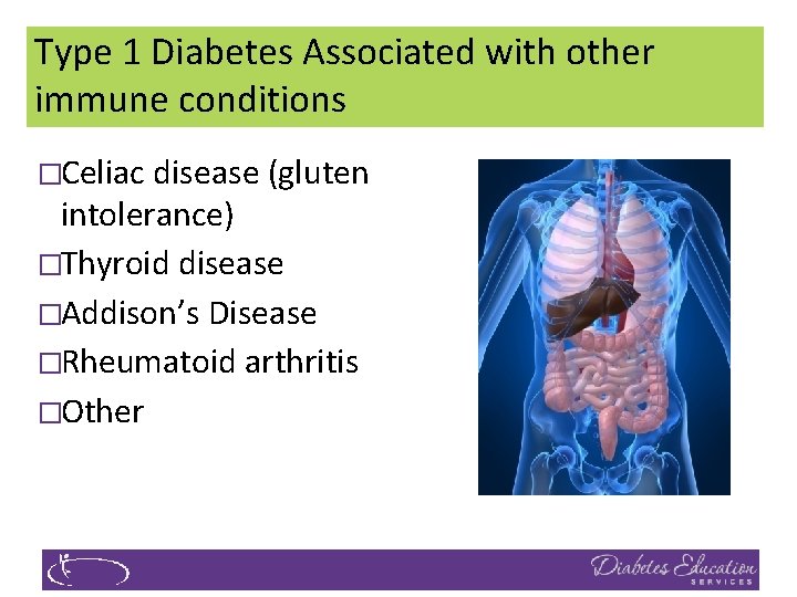Type 1 Diabetes Associated with other immune conditions �Celiac disease (gluten intolerance) �Thyroid disease