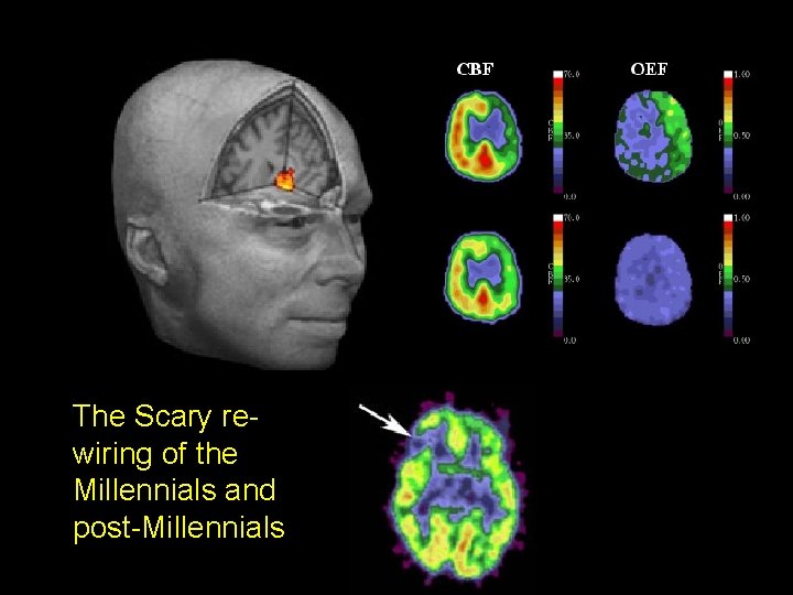 The Scary rewiring of the Millennials and post-Millennials 