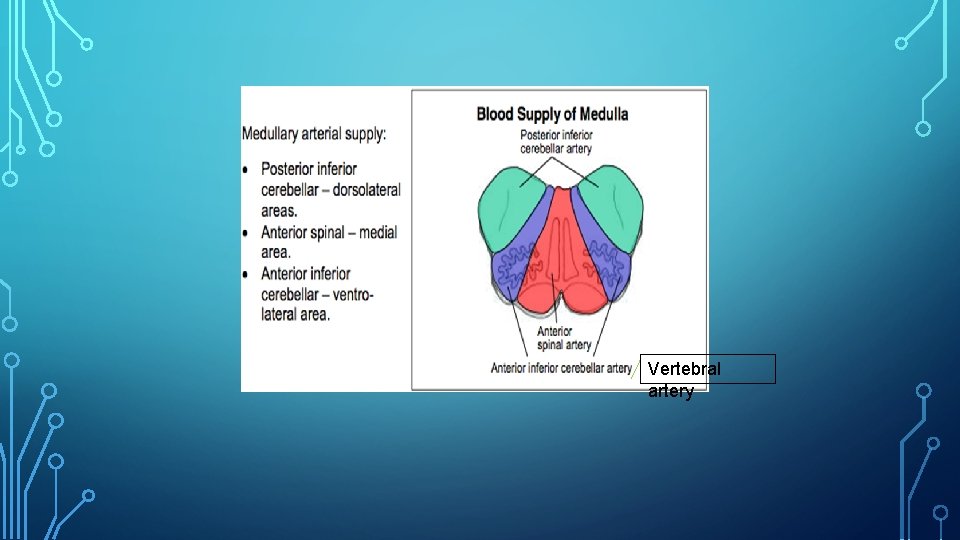 Vertebral artery 
