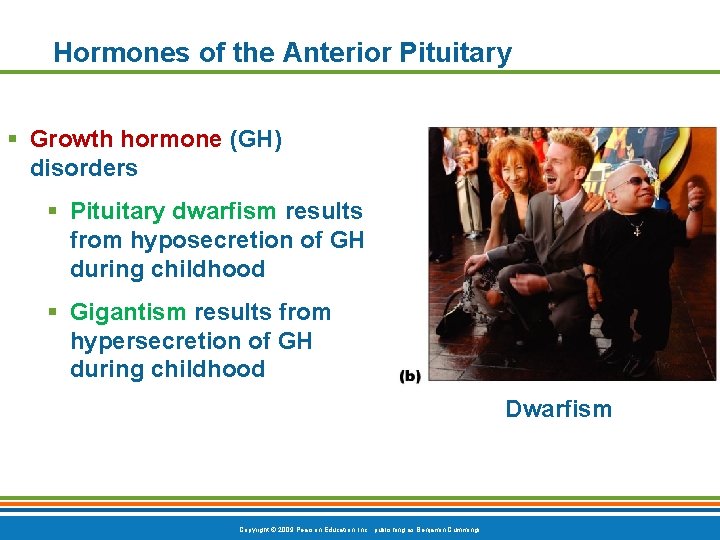 Hormones of the Anterior Pituitary § Growth hormone (GH) disorders § Pituitary dwarfism results