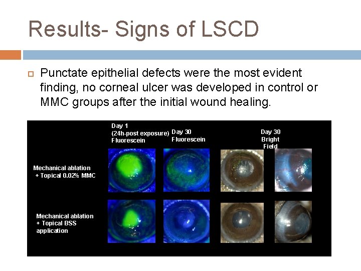 Results- Signs of LSCD Punctate epithelial defects were the most evident finding, no corneal